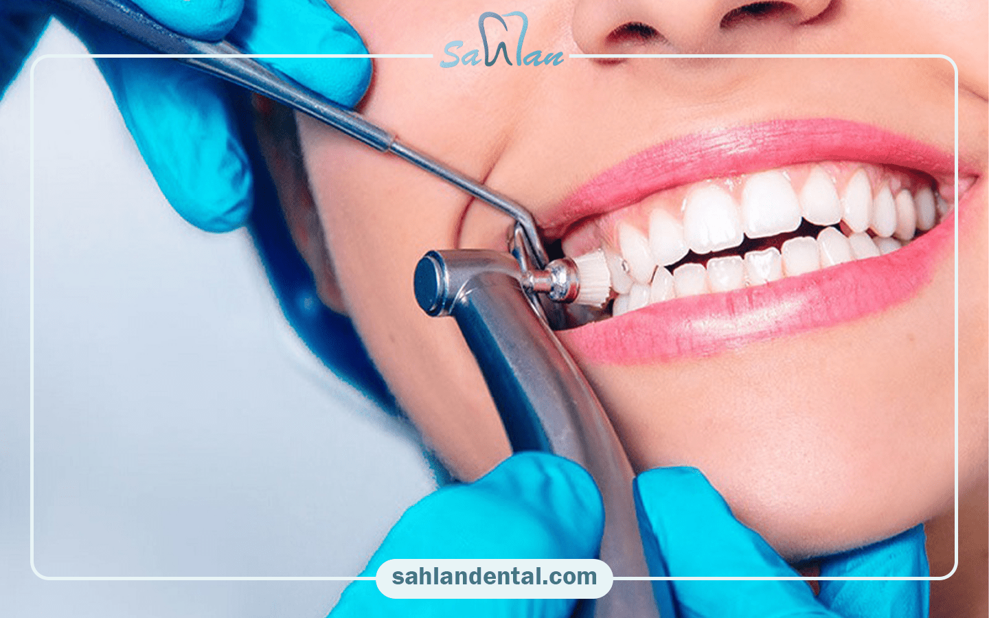 آیا پالیش بعد کامپوزیت ضروری است؟