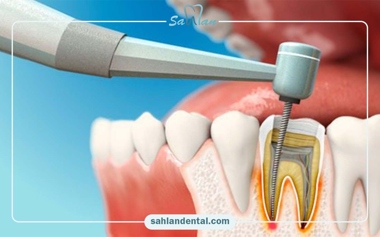 جدول خلاصه عوارض و اقدامات پیشنهادی