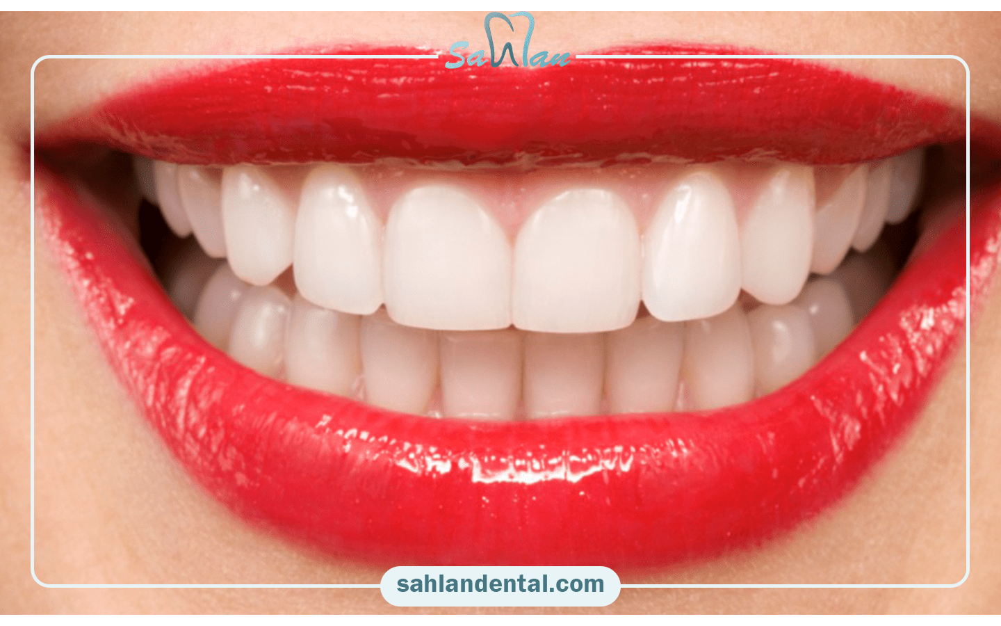 طول عمر کامپوزیت کاریزما