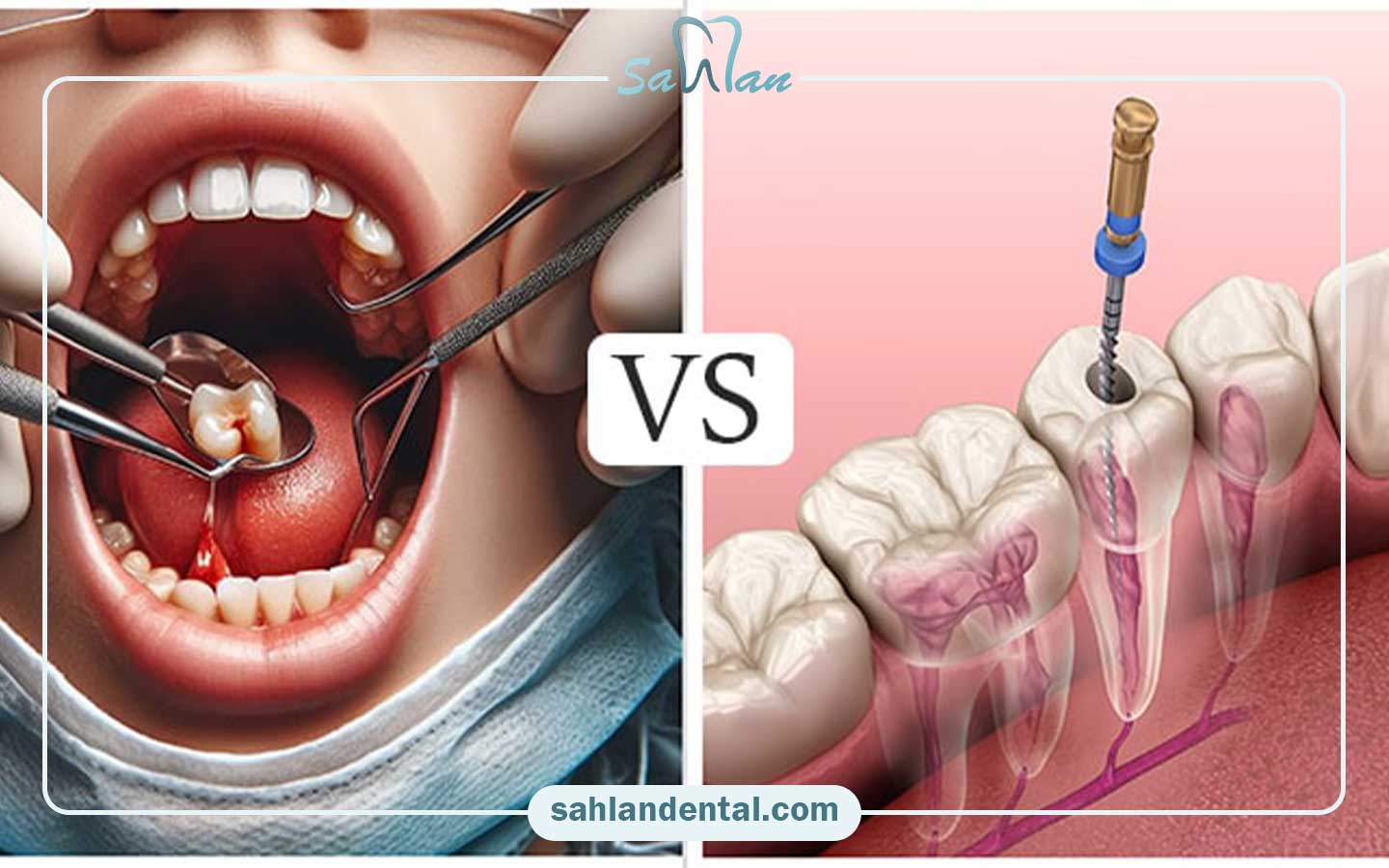 عصب کشی مجدد دندان