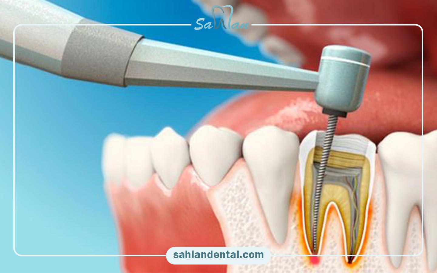 عوارض احتمالی