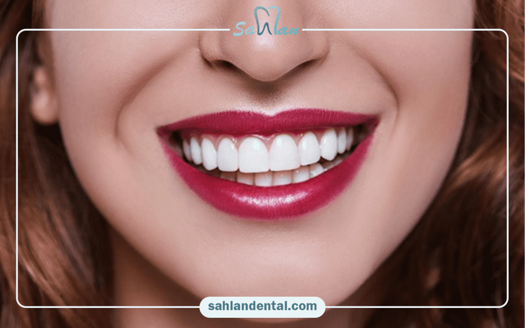 ماندگاری و طول عمر کامپوزیت