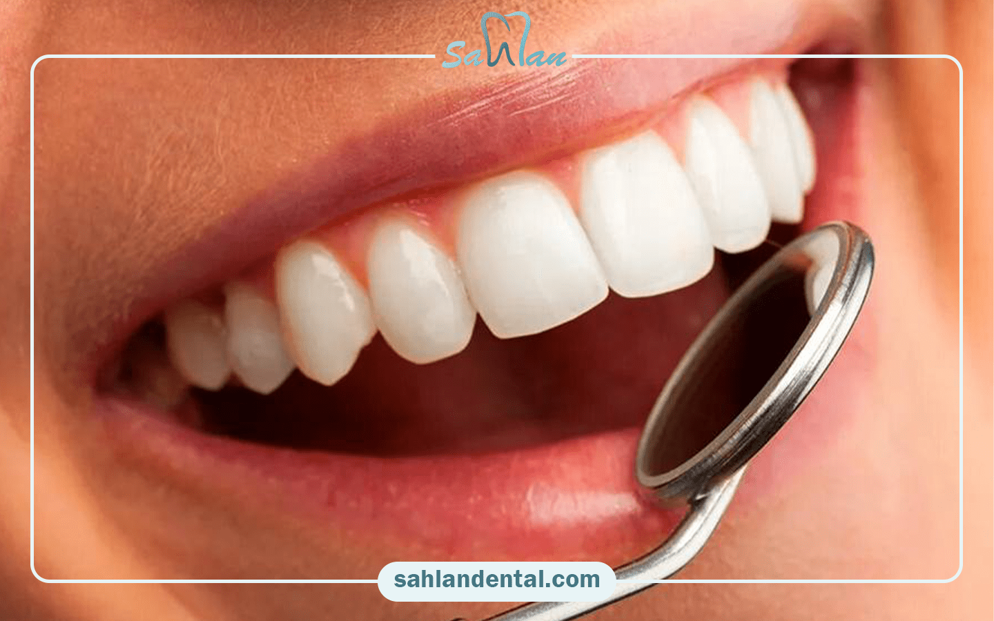 مراحل پالیش کامپوزیت