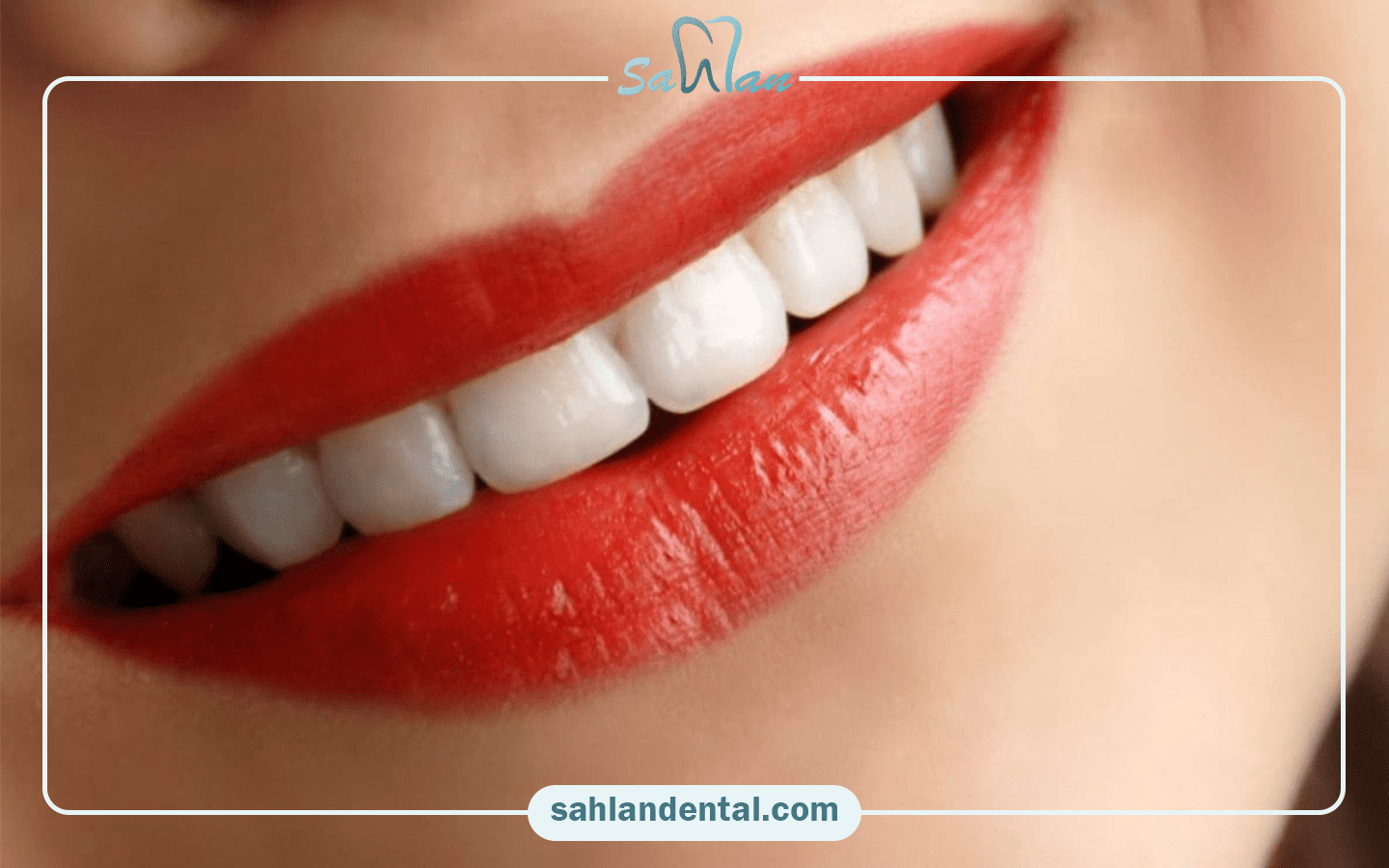 نکات مراقبتی پس از پالیش دندان کامپوزیت