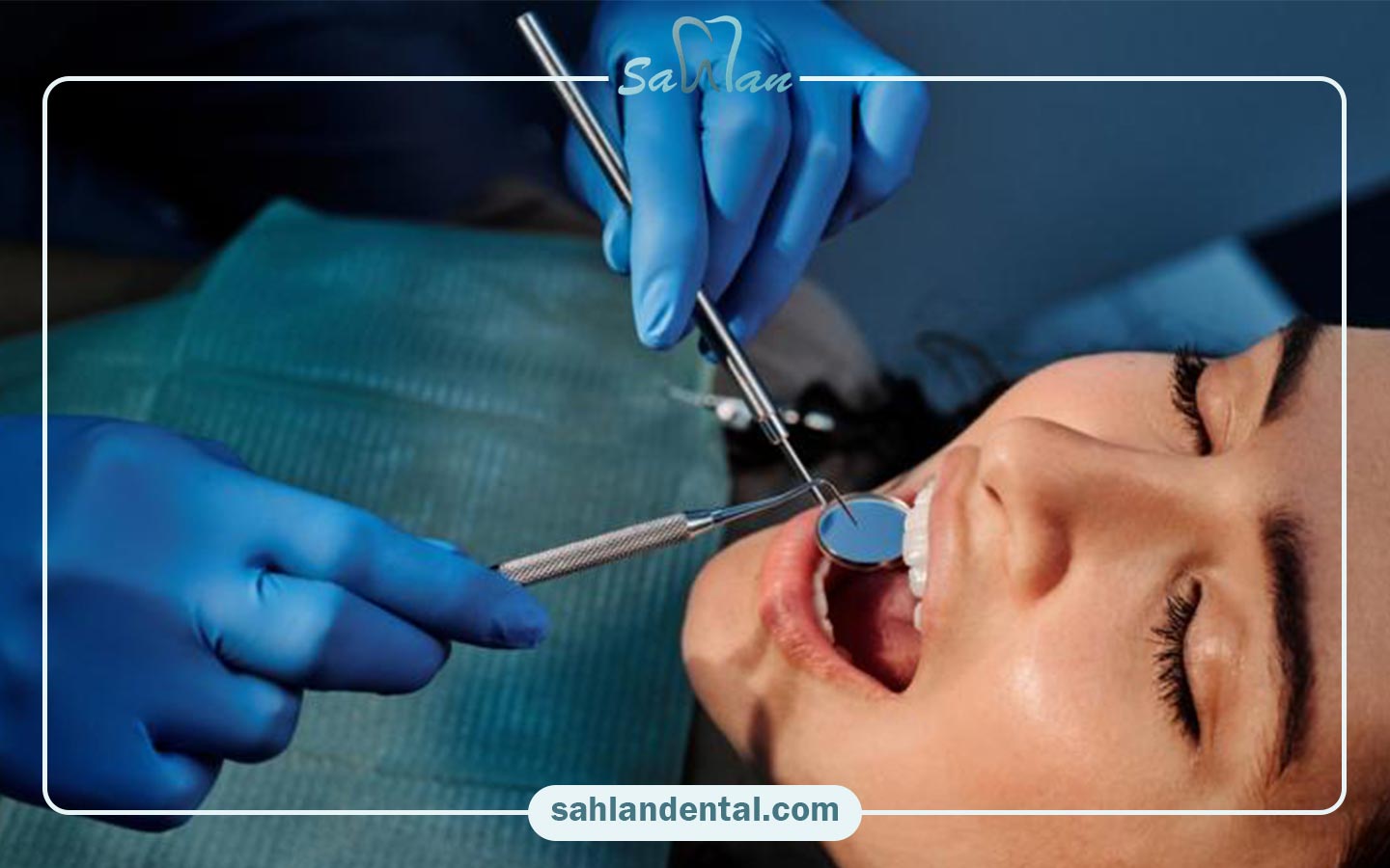 چرا گاهی دندان روکش شده نیاز به عصب کشی دارد