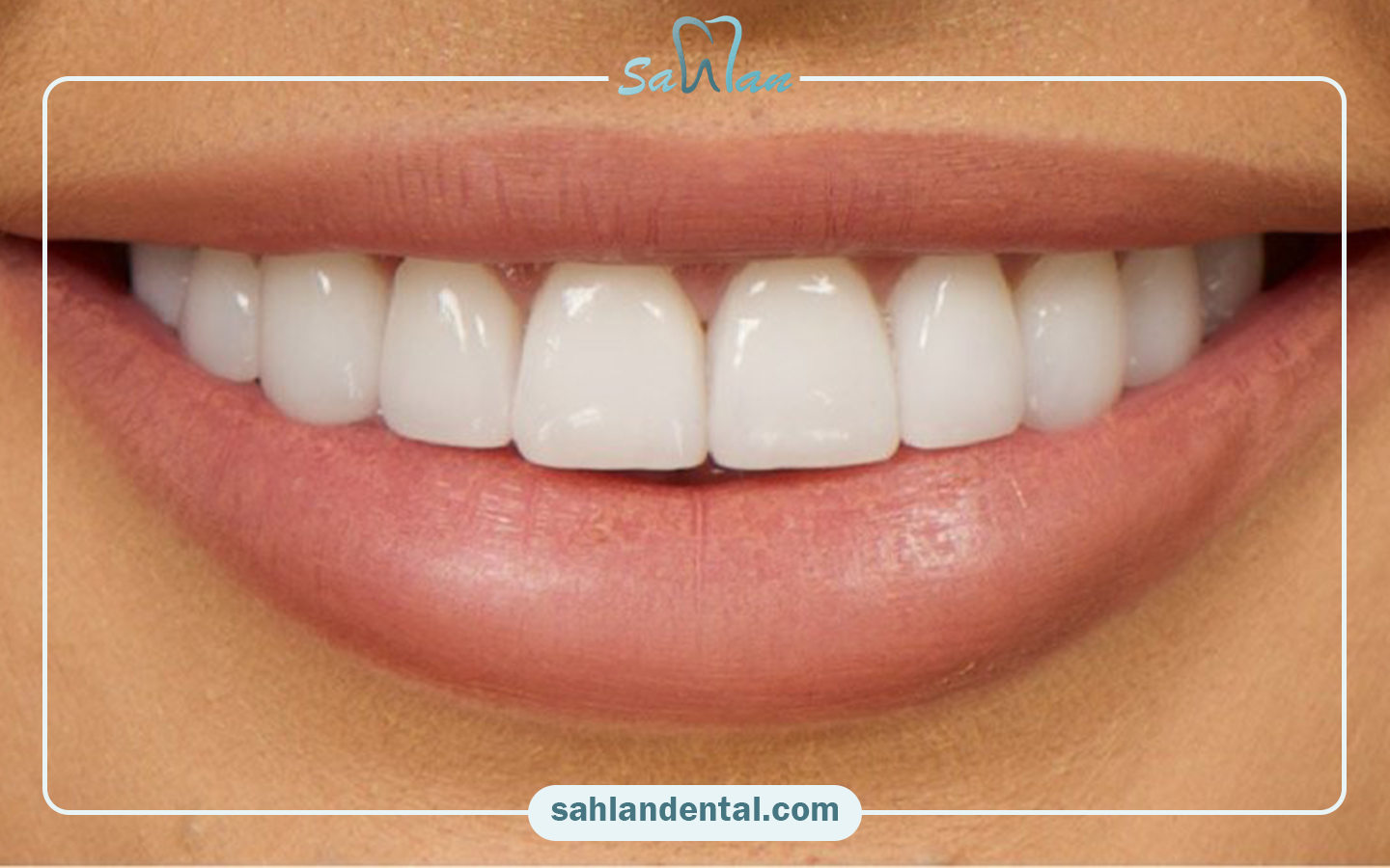 Complications of dry mouth after composite