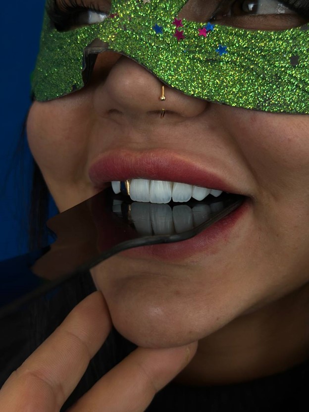 Dental composite