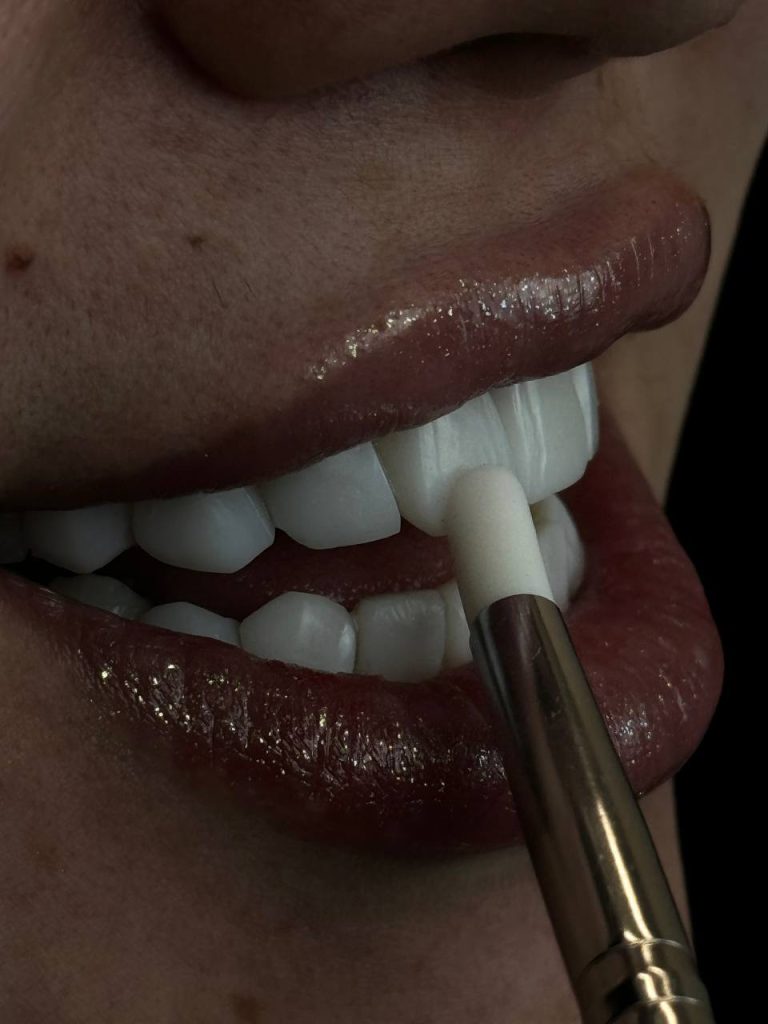 Dental composite