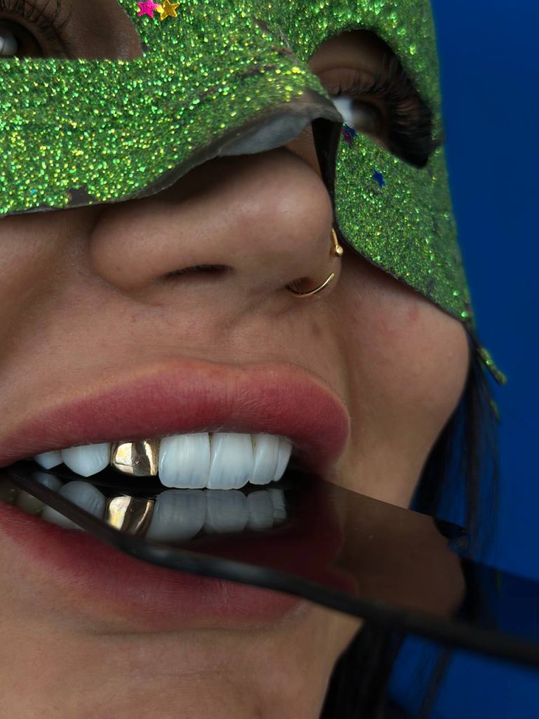 Do you need to grind your teeth for composite?