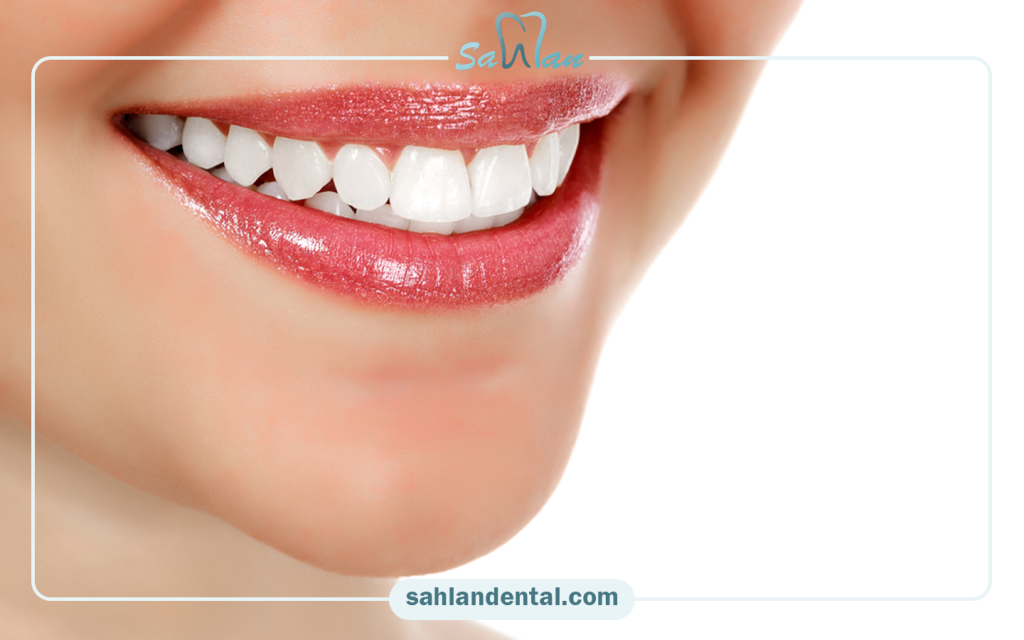 Does dental composite require scaling?