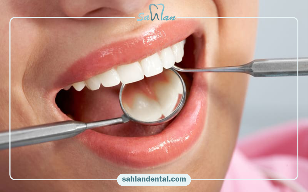 How to take care of your composite while traveling?