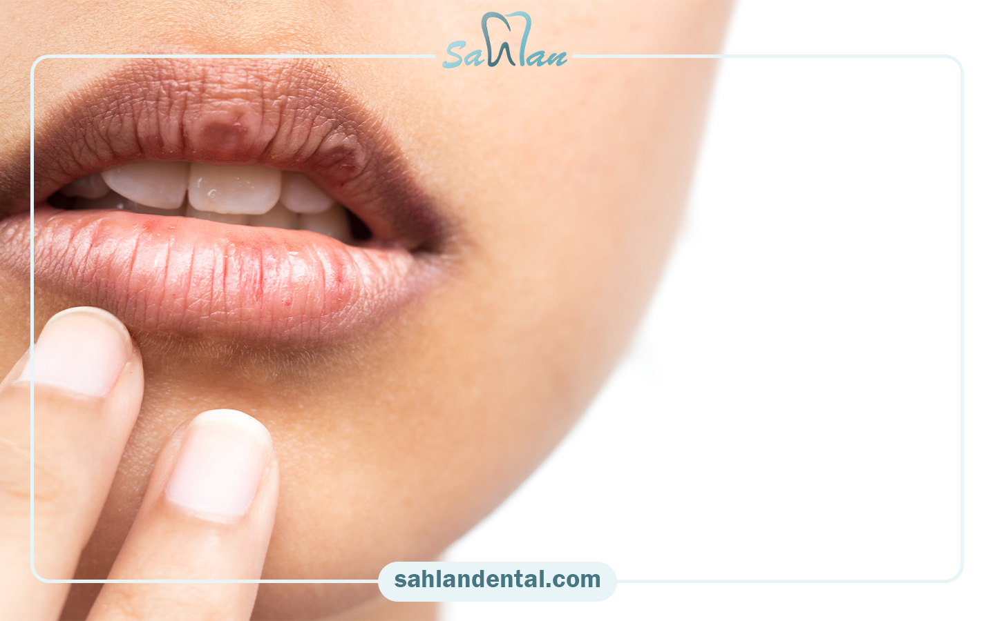 Solutions to deal with dry mouth after composite