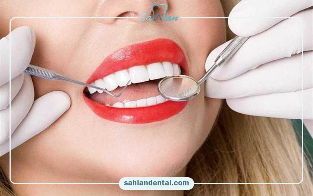 Composite falling off