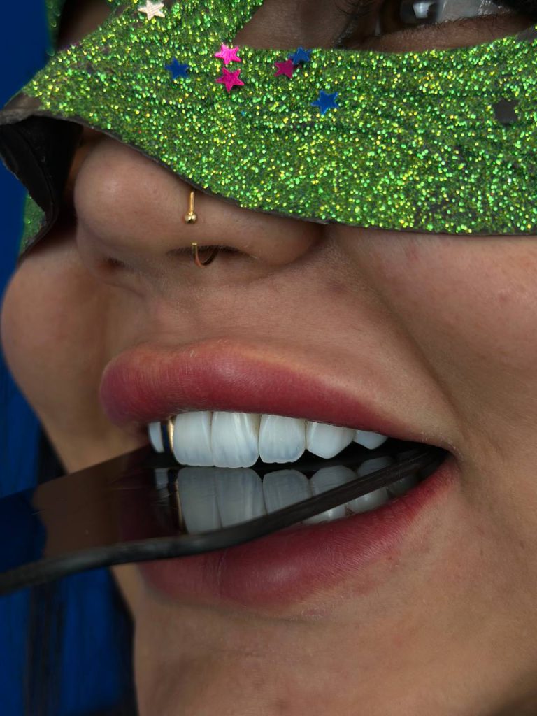 Dental composite