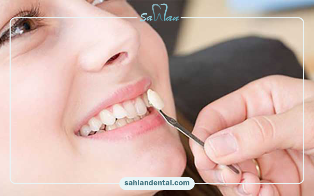 آیا کامپوزیت دندان را می ‌توان به ‌راحتی برداشت؟ (ریمو کامپوزیت)