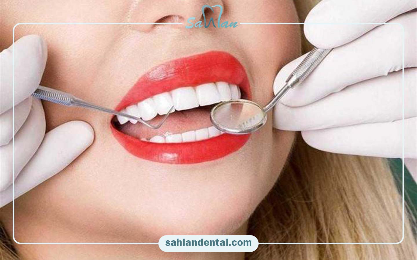 مراقبت‌های بعد از استفاده از کامپوزیت برای دندان‌های حساس