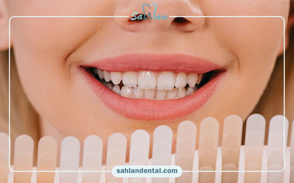 مقایسه سارمکو با برندهای دیگر