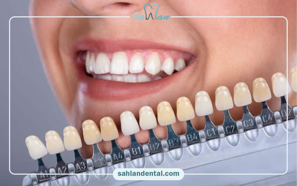 مهم‌ترین ویژگی‌های کامپوزیت سارمکو