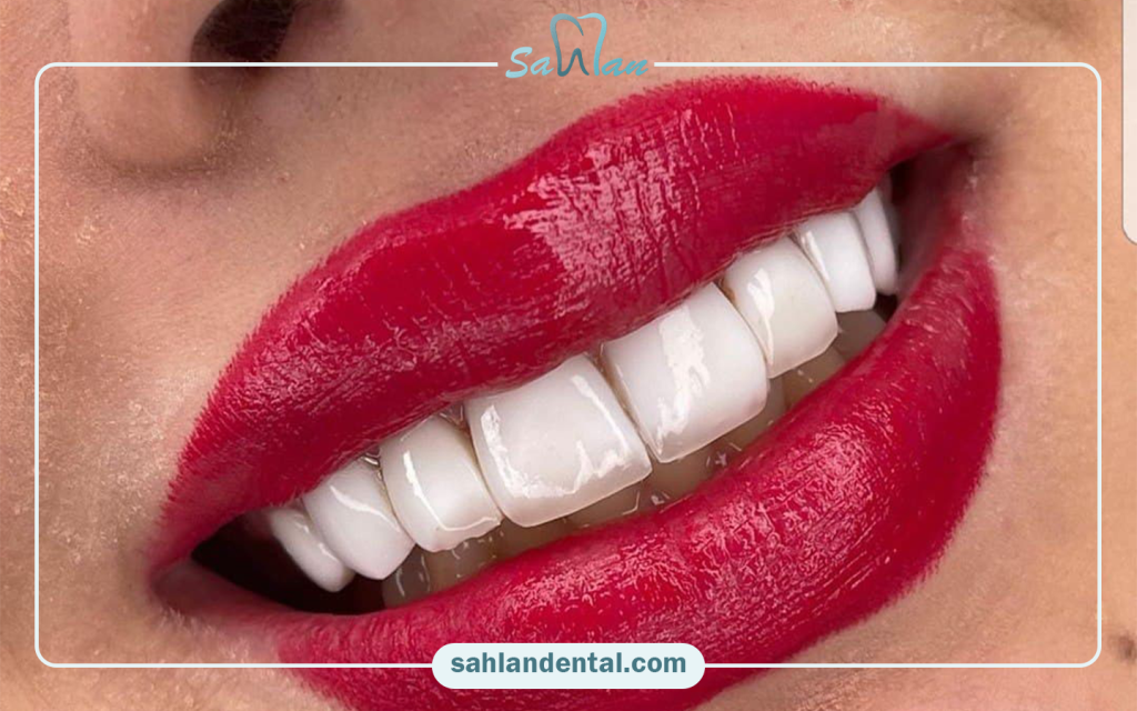 کامپوزیت سارکوما