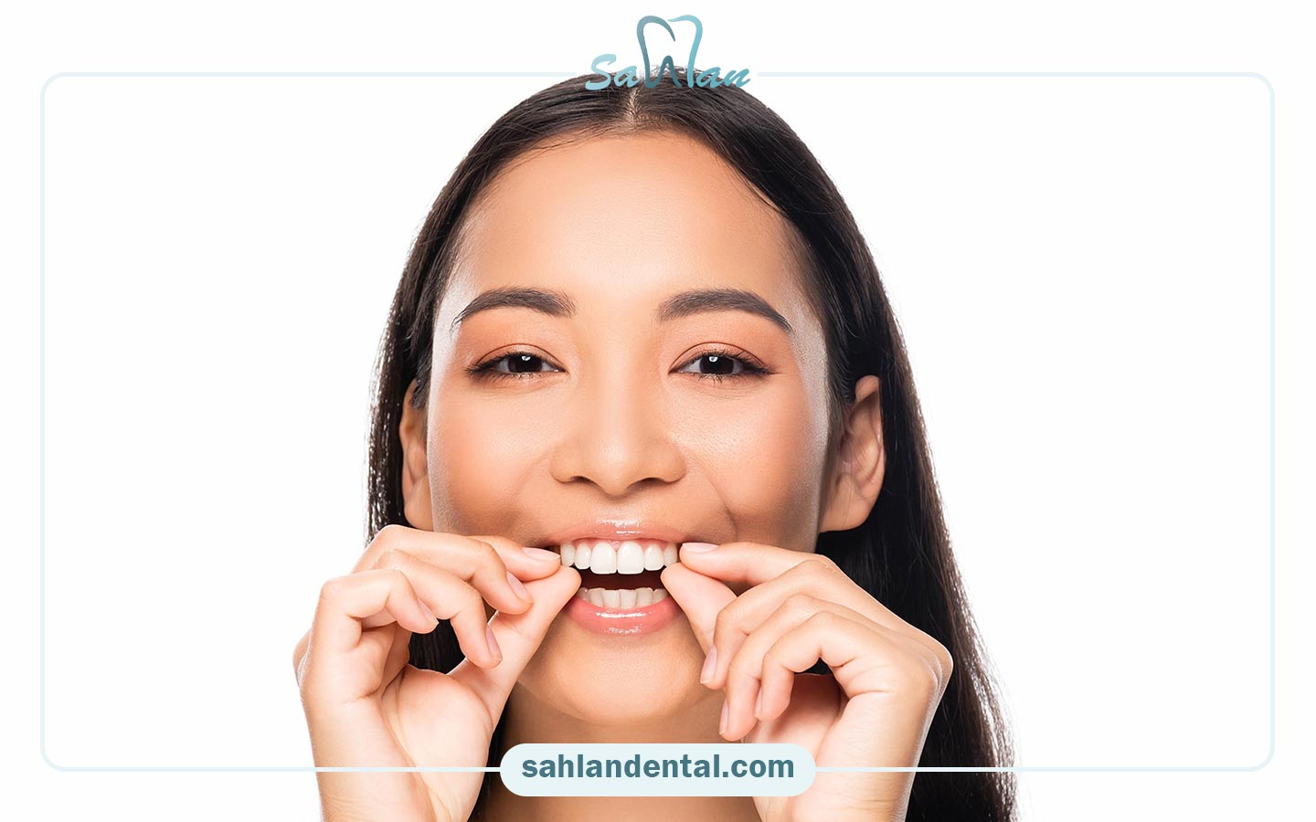 انواع لمینت دندان خرگوشی