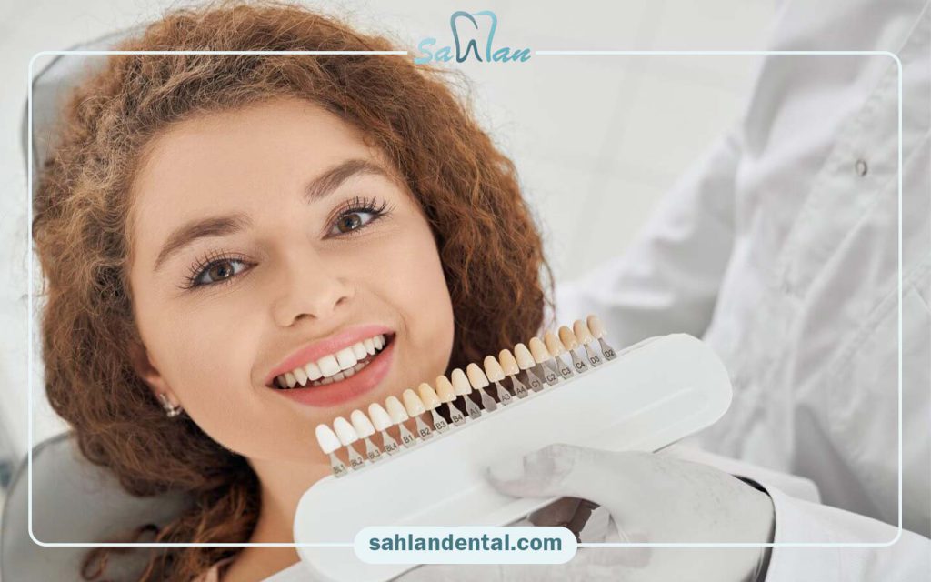 مراقبت های لمینت دند ان