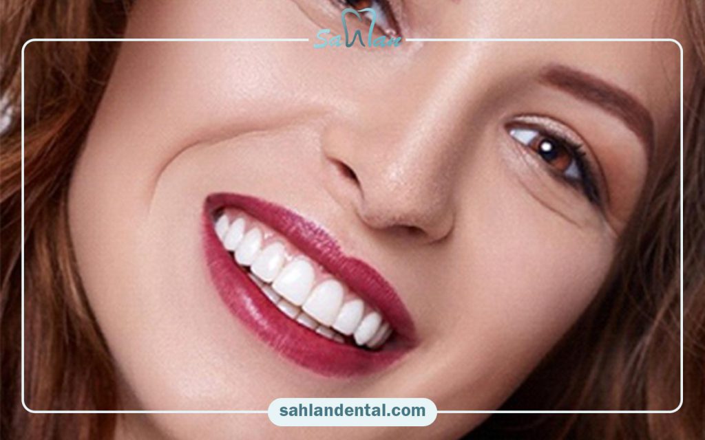مقایسه ضخامت انواع لمینت