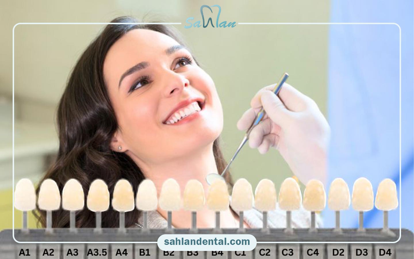 پالت رنگ لمینت دندان و تفاوت‌های اصلی