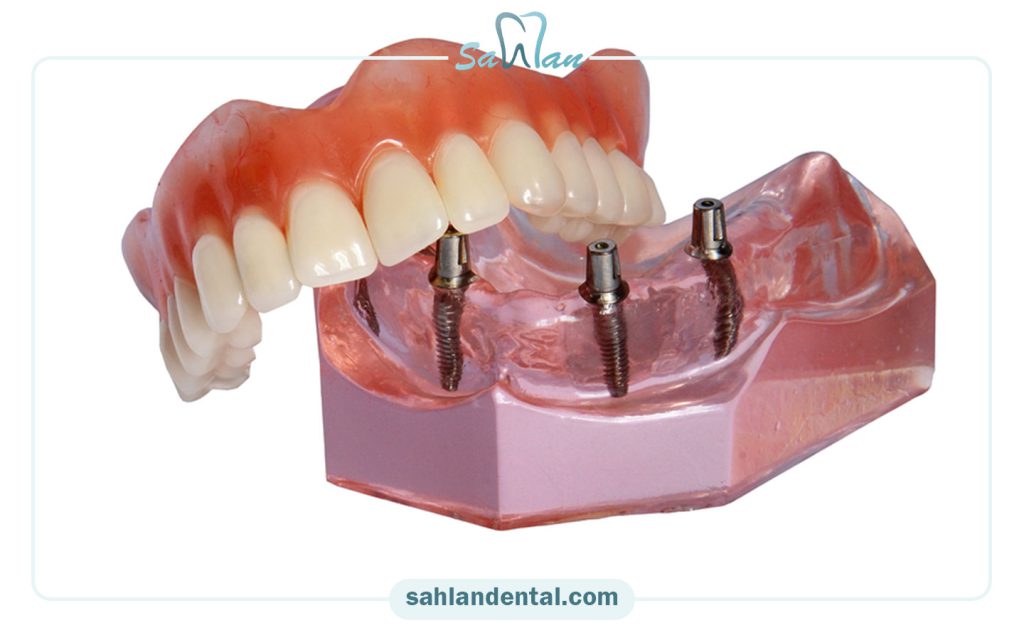 اوردنچر با بیمه ما (کارکنان بانک ملت) در تهران
