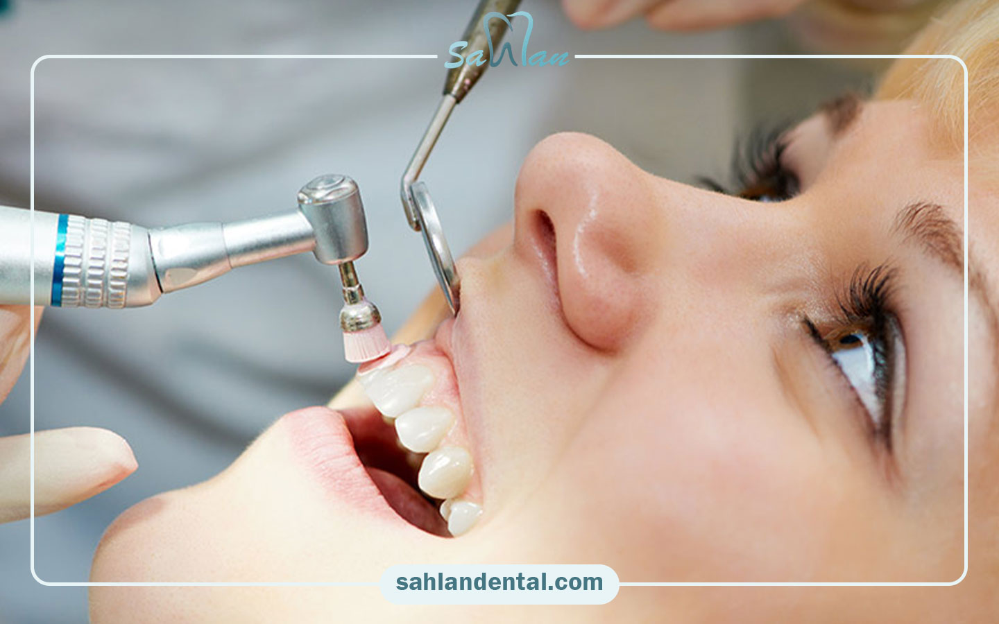 دندانپزشکی سهلان؛ انتخابی مطمئن برای جرم‌گیری
