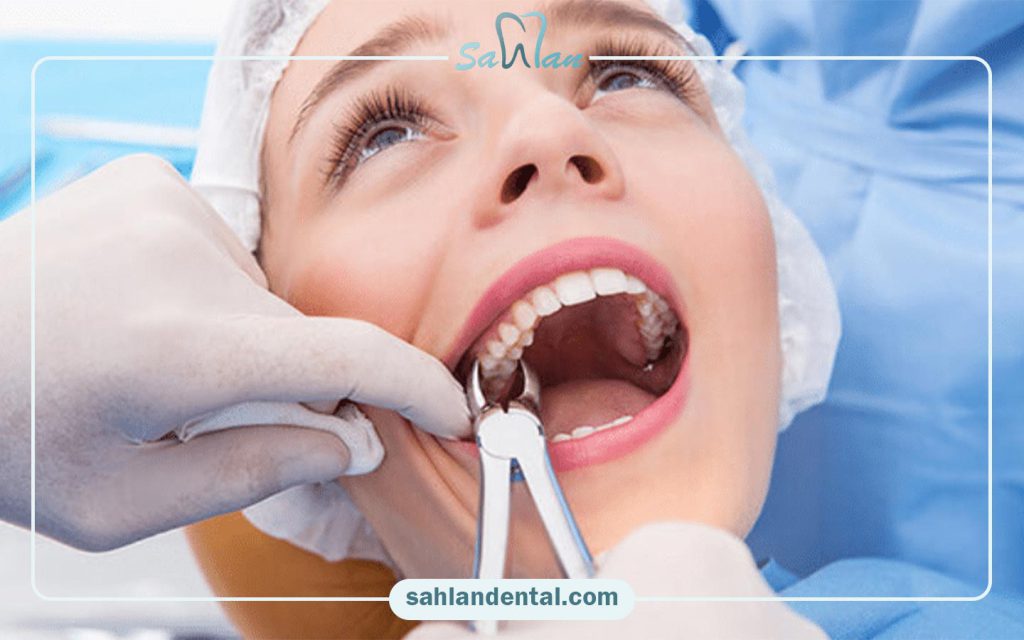 کشیدن دندان با بیمه ما (کارکنان بانک ملت) در تهران