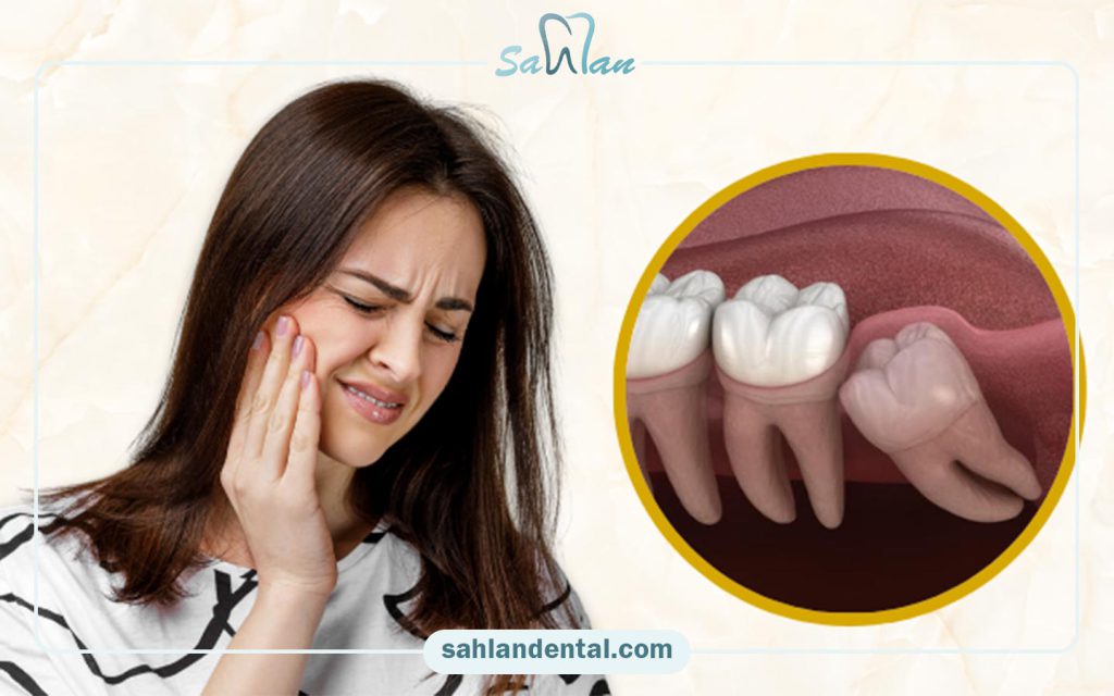 کشیدن دندان عقل با بیمه ما (کارکنان بانک ملت) در تهران