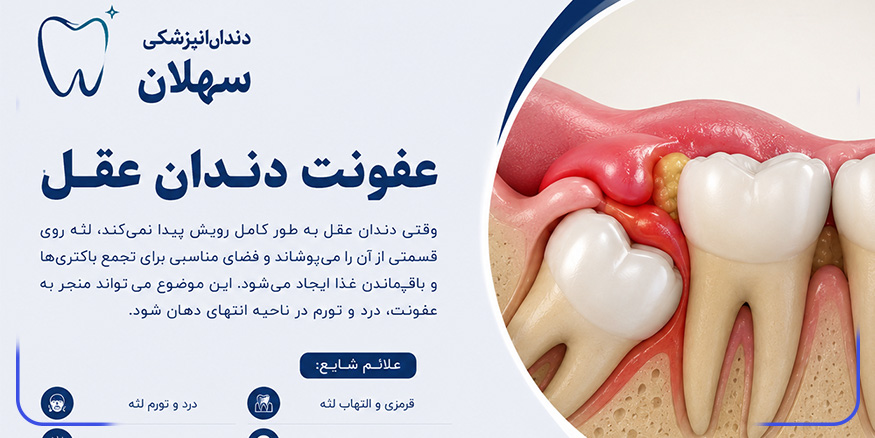 آیا عفونت های دندان عقل خطرناک است