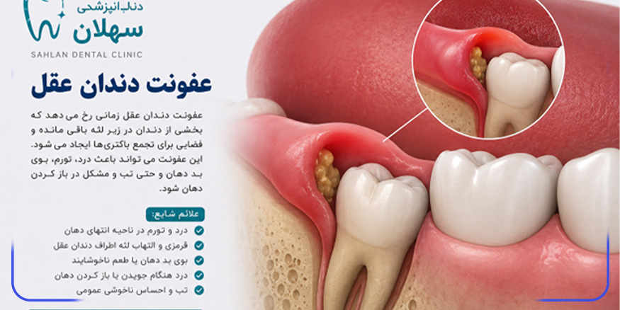عفونت دندان عقل چیست