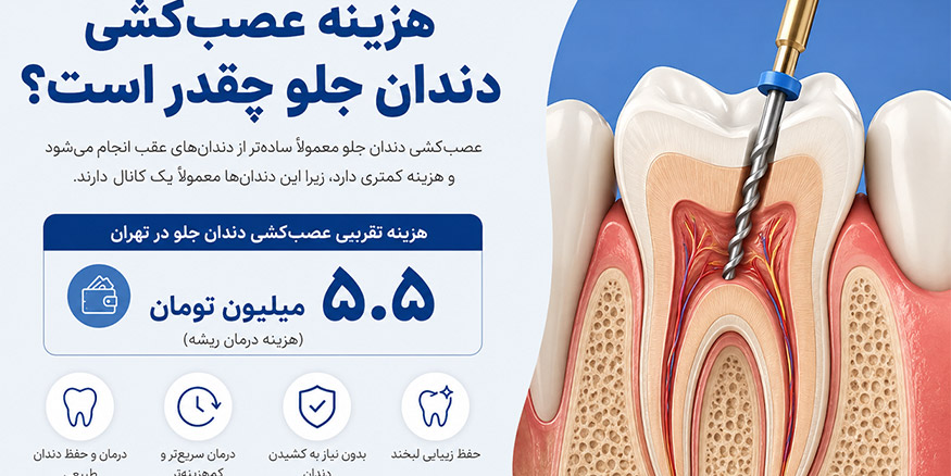 چه عواملی باعث افزایش هزینه عصب‌کشی دندان جلو می‌شوند