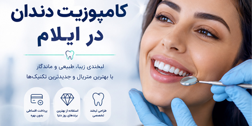 کامپوزیت دندان در ایلام