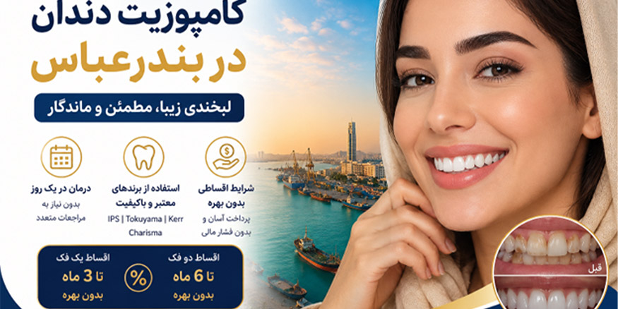کامپوزیت دندان در بندرعباس