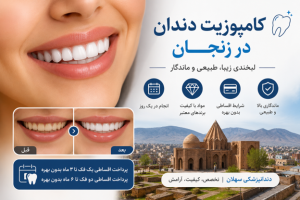 کامپوزیت دندان در زنجان