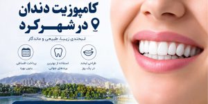 کامپوزیت دندان در شهرکرد
