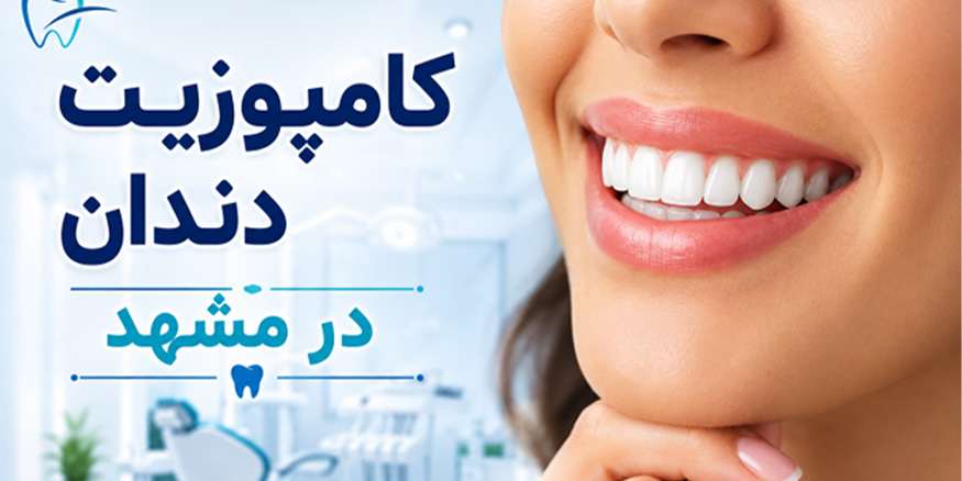 کامپوزیت دندان در مشهد