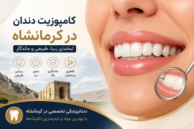 کامپوزیت دندان در کرمانشاه