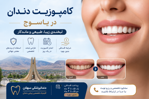 کامپوزیت دندان در یاسوج