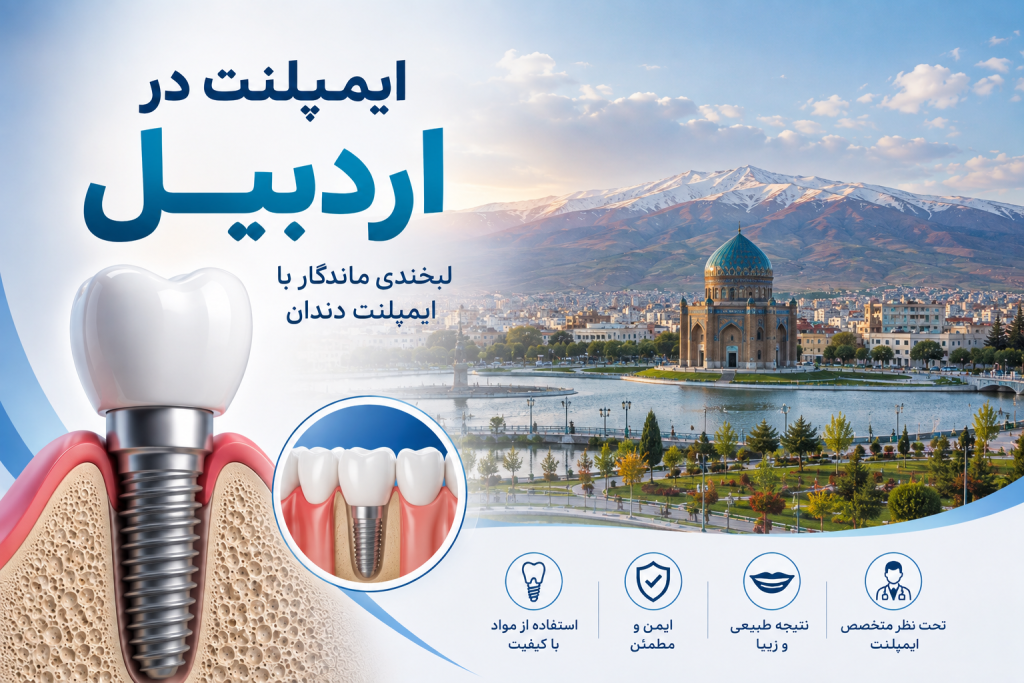 ایمپلنت در اردبیل