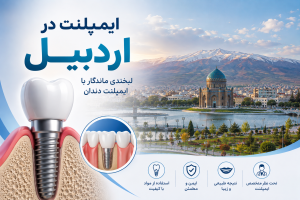 ایمپلنت در اردبیل