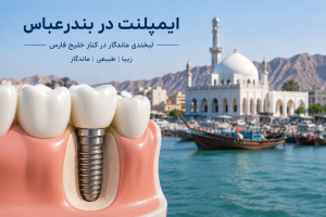 ایمپلنت در بندرعباس