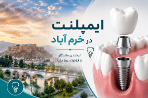 ایمپلنت در خرم آباد