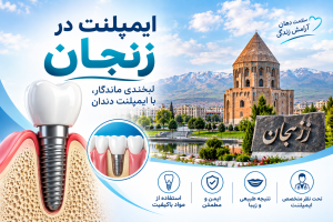 ایمپلنت در زنجان