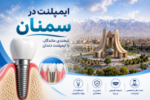 ایمپلنت در سمنان
