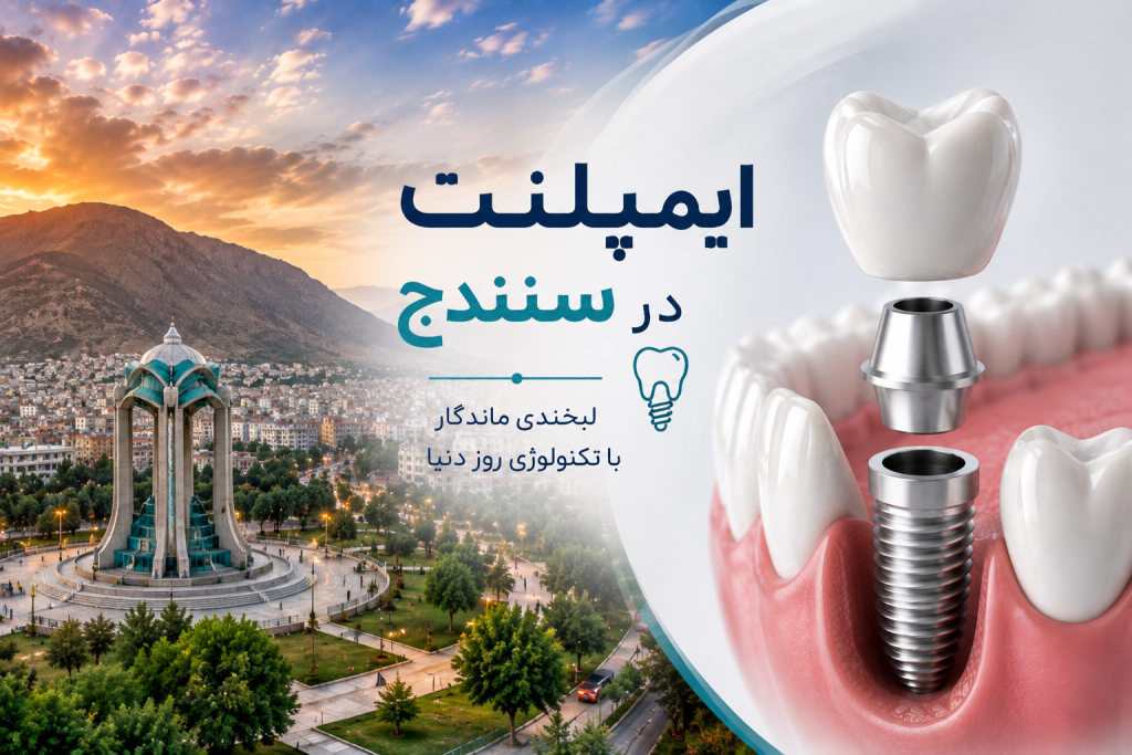 ایمپلنت در سنندج