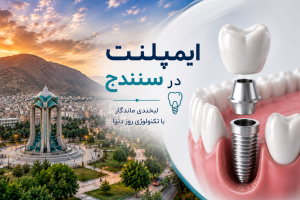 ایمپلنت در سنندج