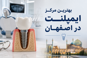 بهترین مرکز ایمپلنت در اصفهان